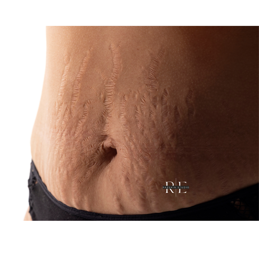 Skin Treatments